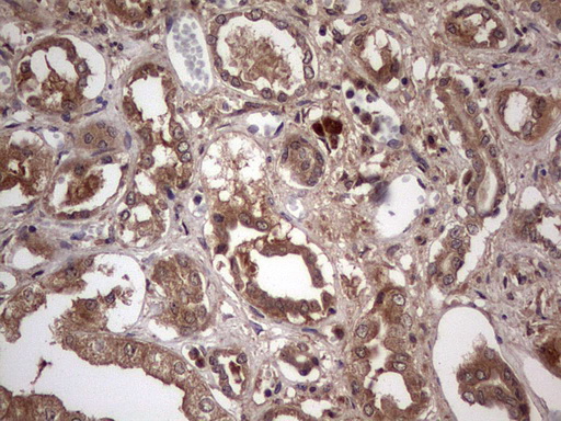 m32358 anti ufd1 mouse monoclonal antibody clone id oti8g6 ihc testing 17