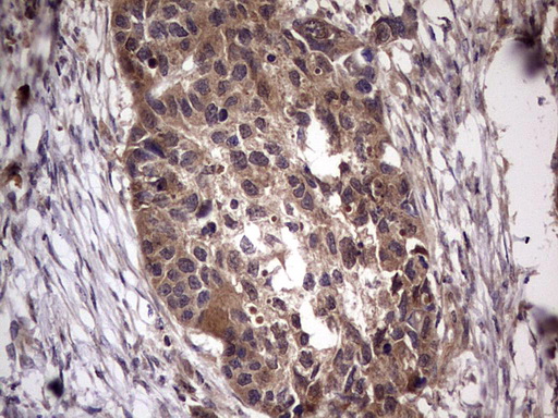 m32358 anti ufd1 mouse monoclonal antibody clone id oti8g6 ihc testing 18