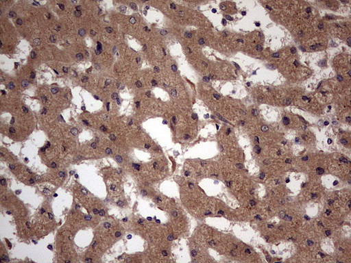 m32358 anti ufd1 mouse monoclonal antibody clone id oti8g6 ihc testing 19