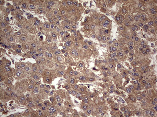 m32358 anti ufd1 mouse monoclonal antibody clone id oti8g6 ihc testing 20