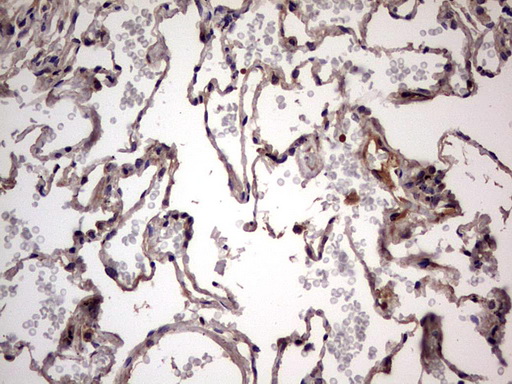 m32358 anti ufd1 mouse monoclonal antibody clone id oti8g6 ihc testing 21