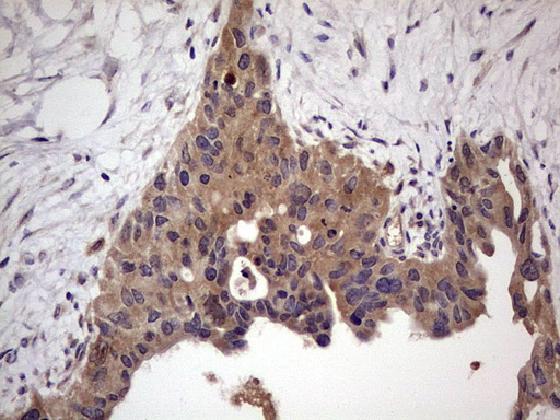 m32358 anti ufd1 mouse monoclonal antibody clone id oti8g6 ihc testing 5