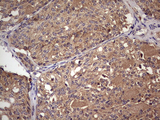m32358 anti ufd1 mouse monoclonal antibody clone id oti8g6 ihc testing 6