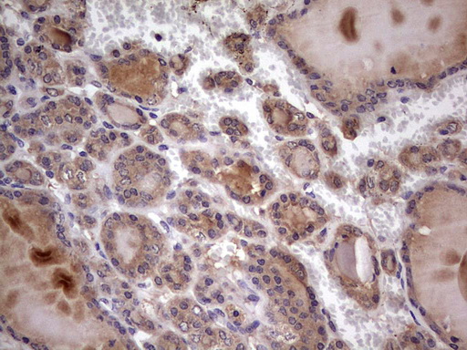 m32358 anti ufd1 mouse monoclonal antibody clone id oti8g6 ihc testing 7