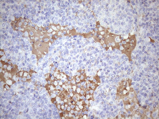 m32369 anti p90 autoantigen kiaa1524 mouse monoclonal antibody clone id oti1c11 ihc testing 2