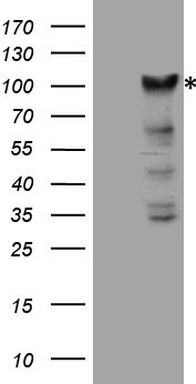 m32369 anti p90 autoantigen kiaa1524 mouse monoclonal antibody clone id oti1c11 wb testing 1