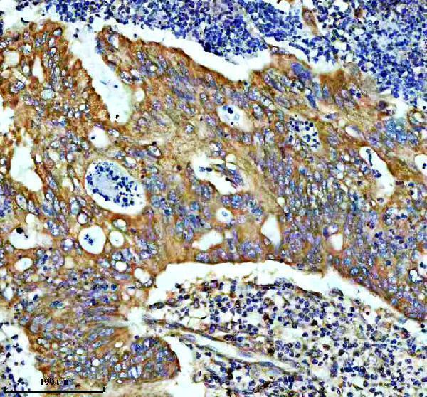 IHC analysis of GUCY1B1 using anti-GUCY1B1 antibody (M32396)
