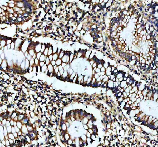 IHC analysis of GUCY1B1 using anti-GUCY1B1 antibody (M32396)