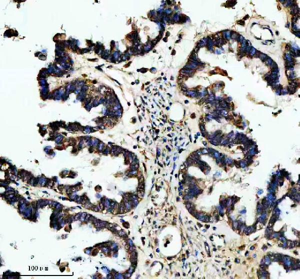m32396 gucy1b1 primary antibodies ihc testing 3_1
