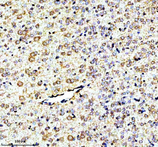 m32396 gucy1b1 primary antibodies ihc testing 4_1