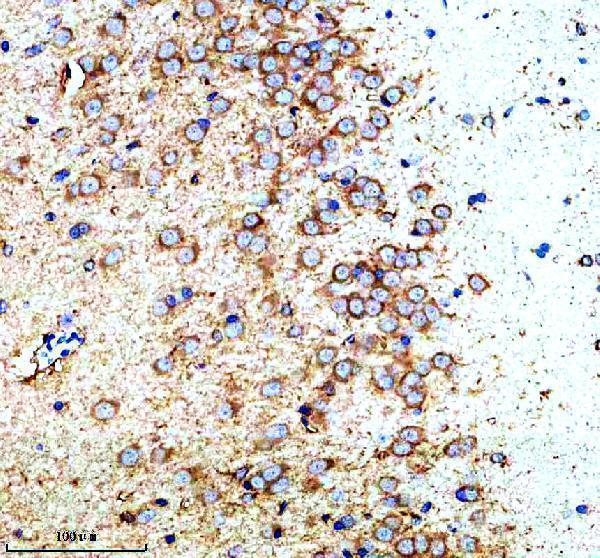 m32396 gucy1b1 primary antibodies ihc testing 5_1
