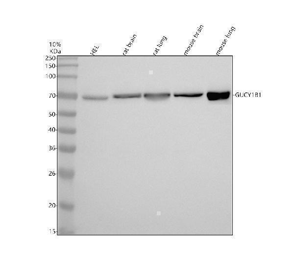 Western blot analysis of GUCY1B1 using anti-GUCY1B1 antibody (M32396)