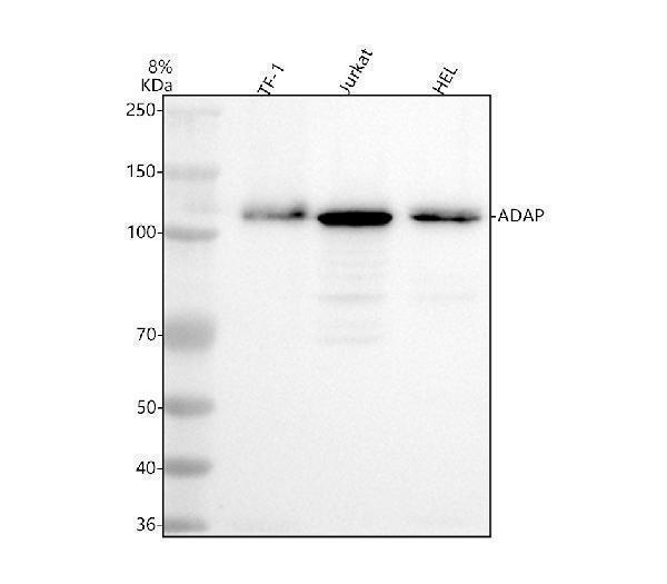  Western blot analysis of FYB using anti-FYB antibody (M32410-1)