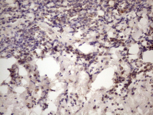 m32411 anti inava mouse monoclonal antibody clone id oti6a6 ihc testing 4