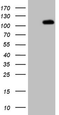 HEK293T cells were transfected with the pCMV6-ENTRY control (Left lane) or pCMV6-ENTRY C1orf106 (Right lane) cDNA for 48 hrs and lysed