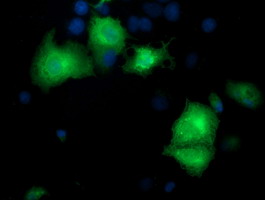 m32428 1 anti pycr3 mouse monoclonal antibody clone id oti3e1 if testing 14