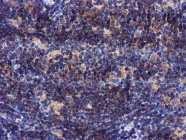 m32428 1 anti pycr3 mouse monoclonal antibody clone id oti3e1 ihc testing 10