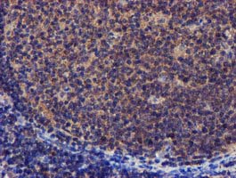 m32428 1 anti pycr3 mouse monoclonal antibody clone id oti3e1 ihc testing 11