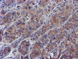 m32428 1 anti pycr3 mouse monoclonal antibody clone id oti3e1 ihc testing 12