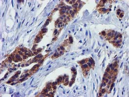 m32428 1 anti pycr3 mouse monoclonal antibody clone id oti3e1 ihc testing 3