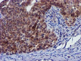 m32428 1 anti pycr3 mouse monoclonal antibody clone id oti3e1 ihc testing 4