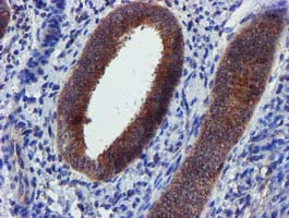m32428 1 anti pycr3 mouse monoclonal antibody clone id oti3e1 ihc testing 5