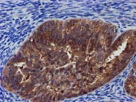 m32428 1 anti pycr3 mouse monoclonal antibody clone id oti3e1 ihc testing 6