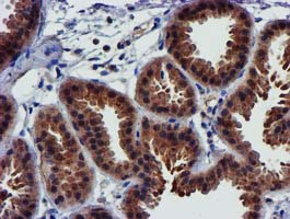 m32428 1 anti pycr3 mouse monoclonal antibody clone id oti3e1 ihc testing 7