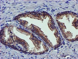m32428 1 anti pycr3 mouse monoclonal antibody clone id oti3e1 ihc testing 8