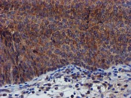 m32428 1 anti pycr3 mouse monoclonal antibody clone id oti3e1 ihc testing 9