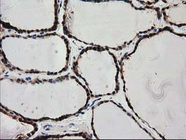 m32428 2 anti pycr3 mouse monoclonal antibody clone id oti1b12 ihc testing 4