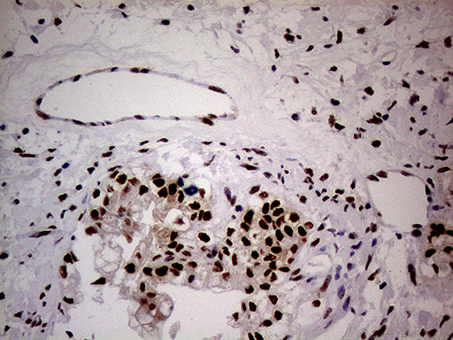 m32443 anti nsd3 whsc1l1 mouse monoclonal antibody clone id oti3b3 ihc testing 2