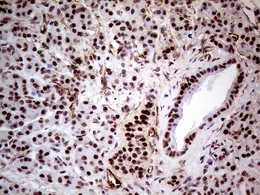 m32443 anti nsd3 whsc1l1 mouse monoclonal antibody clone id oti3b3 ihc testing 3