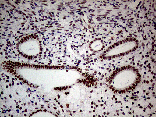 m32443 anti nsd3 whsc1l1 mouse monoclonal antibody clone id oti3b3 ihc testing 4