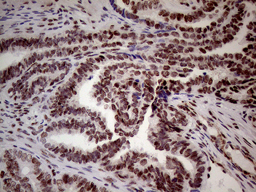 m32443 anti nsd3 whsc1l1 mouse monoclonal antibody clone id oti3b3 ihc testing 5