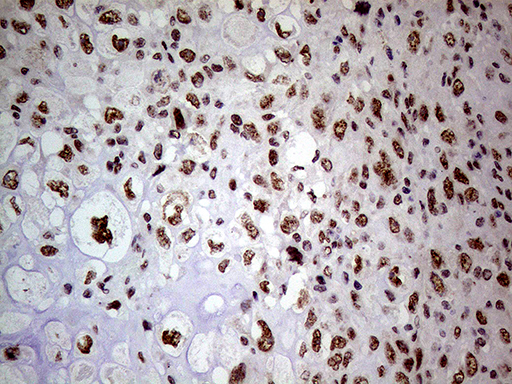 m32443 anti nsd3 whsc1l1 mouse monoclonal antibody clone id oti3b3 ihc testing 6