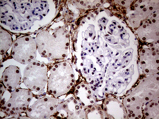 m32443 anti nsd3 whsc1l1 mouse monoclonal antibody clone id oti3b3 ihc testing 7