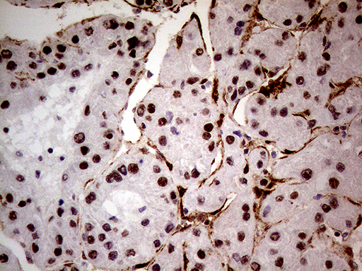 m32443 anti nsd3 whsc1l1 mouse monoclonal antibody clone id oti3b3 ihc testing 8
