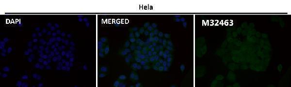 m32463 icc1