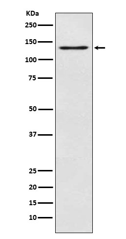 Western blot analysis of MGEA5 expression in JAR cell lysate