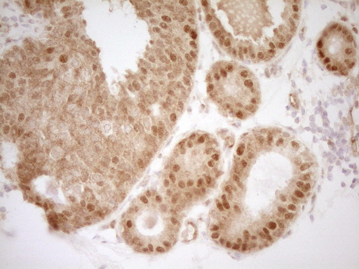 m32468 anti mrtfa mouse monoclonal antibody clone id oti3g7 ihc testing 2