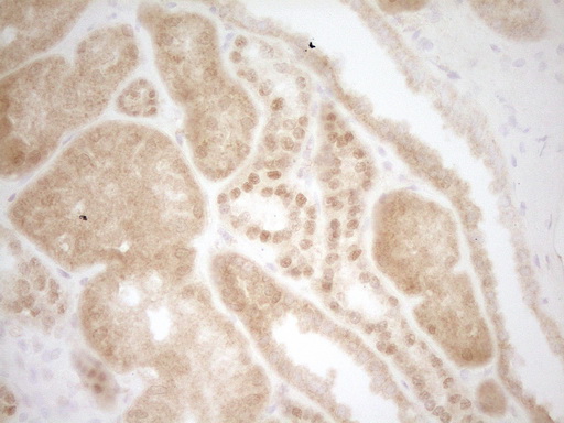 m32468 anti mrtfa mouse monoclonal antibody clone id oti3g7 ihc testing 3