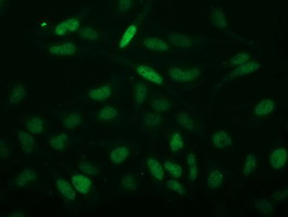 m32743 anti ecrg4 mouse monoclonal antibody clone id oti3b10 if testing 4