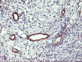 m33920 anti lratd2 mouse monoclonal antibody clone id oti1d12 ihc testing 2