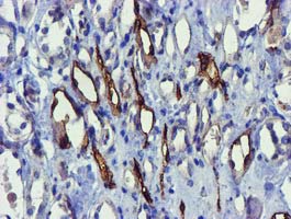 m33920 anti lratd2 mouse monoclonal antibody clone id oti1d12 ihc testing 3