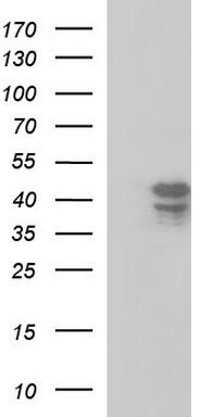 HEK293T cells were transfected with the pCMV6-ENTRY control (Left lane) or pCMV6-ENTRY SEPT1 (Right lane) cDNA for 48 hrs and lysed