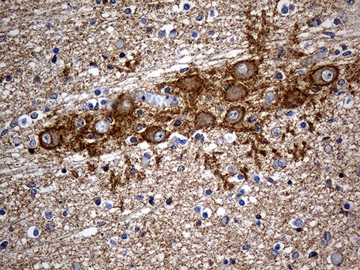 Immunohistochemical staining of paraffin-embedded Human embryonic cerebellum within the normal limits using anti-SEPT3 mouse monoclonal antibody