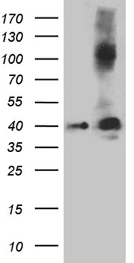 HEK293T cells were transfected with the pCMV6-ENTRY control (Left lane) or pCMV6-ENTRY SEPT3 (Right lane) cDNA for 48 hrs and lysed