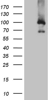 HEK293T cells were transfected with the pCMV6-ENTRY control (Left lane) or pCMV6-ENTRY MUM1 (Right lane) cDNA for 48 hrs and lysed