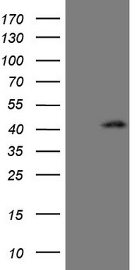 HEK293T cells were transfected with the pCMV6-ENTRY control (Left lane) or pCMV6-ENTRY CTGF (Right lane) cDNA for 48 hrs and lysed